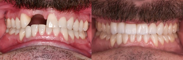Images Hoopes Dental