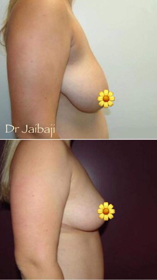 Jaibaji Plastic Surgery Photo