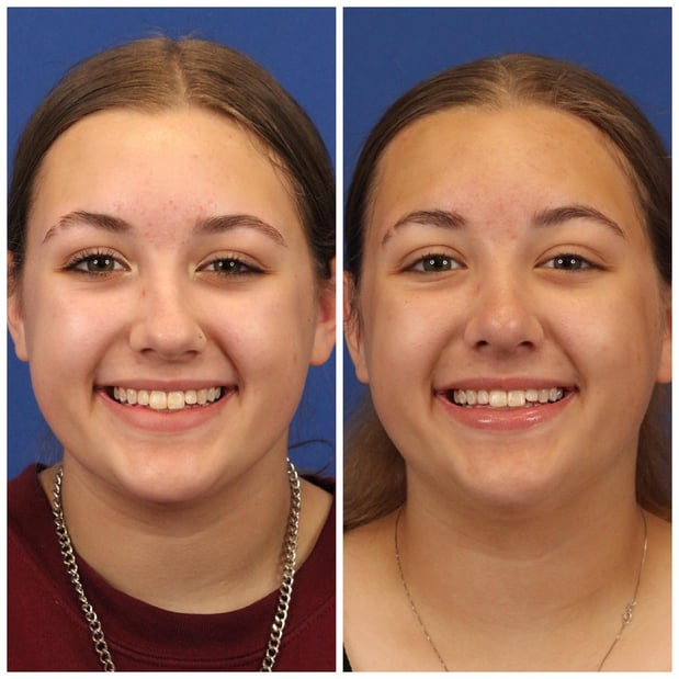 Images Dr. Sumit Bapna, MD