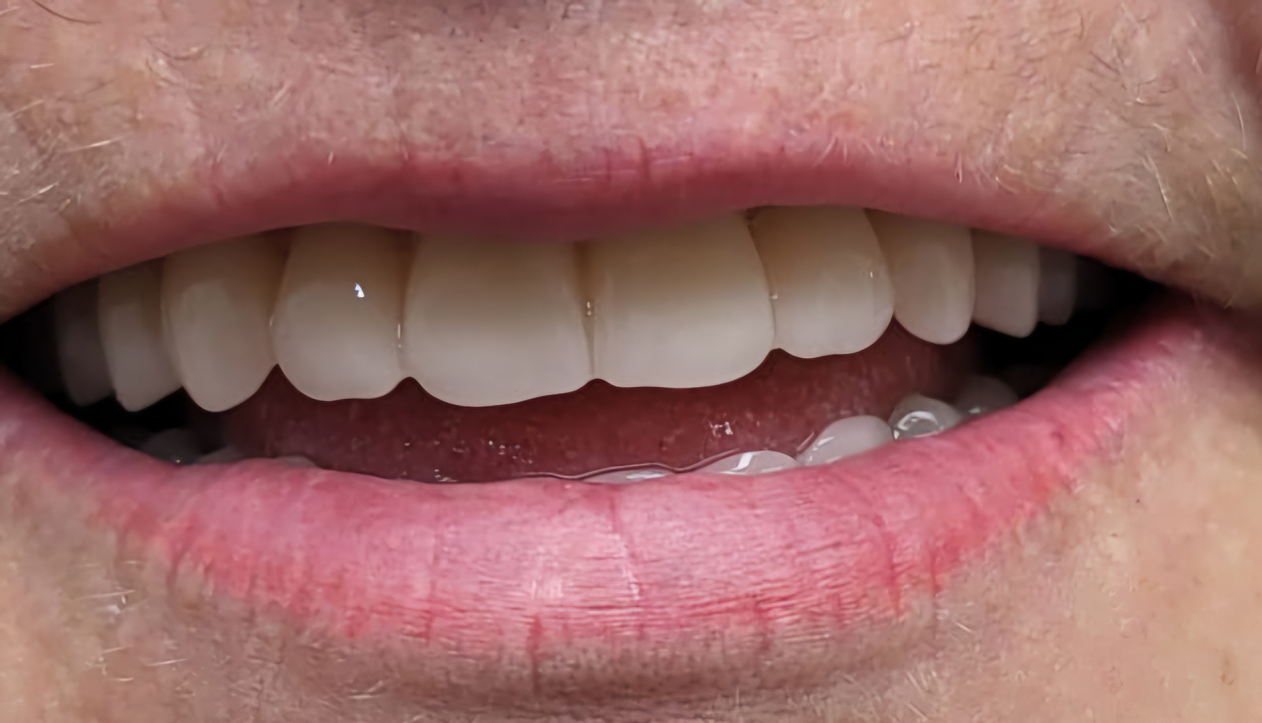 Images Damon Denture Designs Pty Ltd