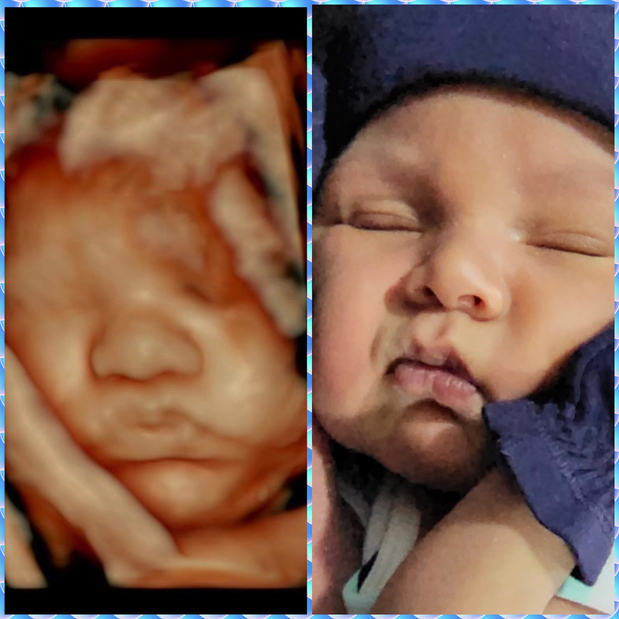 Images 4D Baby Ultrasound Studio
