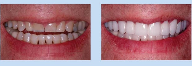 Images Lincoln Family Dentistry