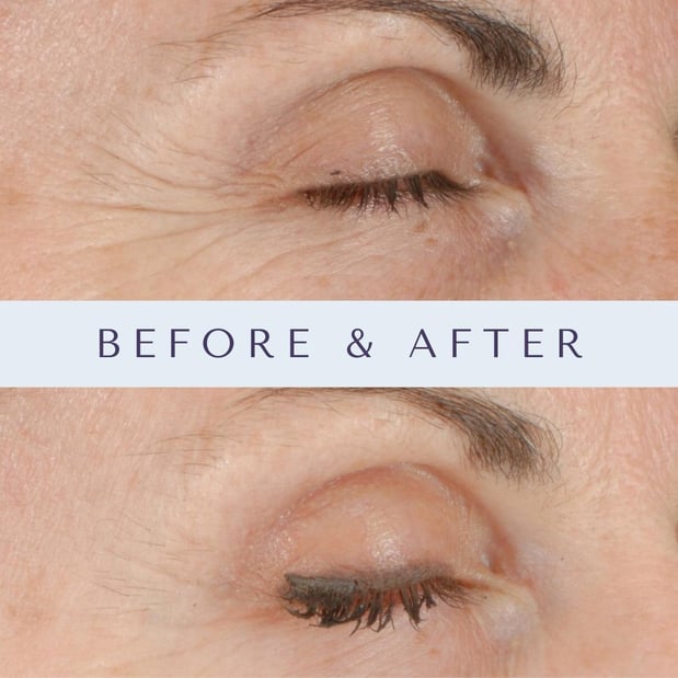 Images Mariposa Aesthetics & Laser Center