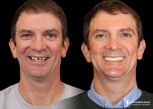 Images Birmingham Dental Implant Studio
