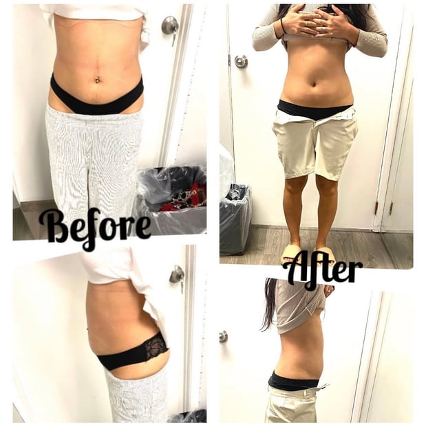 Images Queen Divas Body Sculpting