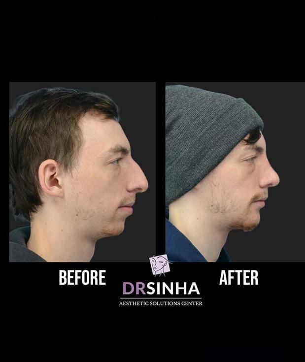 Images Pradeep K Sinha MD PhD FACS - Facial Aesthetic Surgery