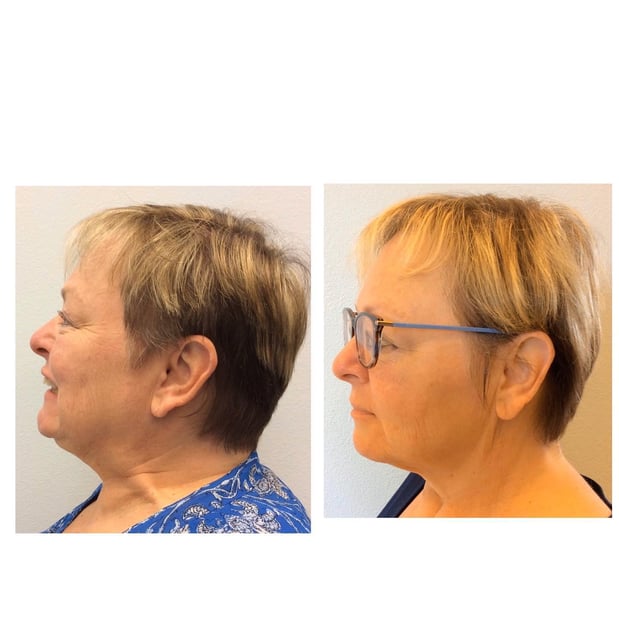 Images Lifetime Dental & Fastbraces