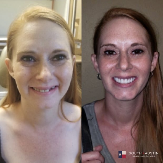 Images South Austin Dental Associates