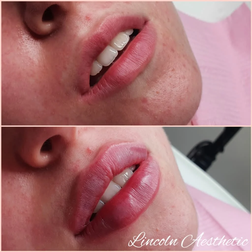 Images Lincoln Aesthetic