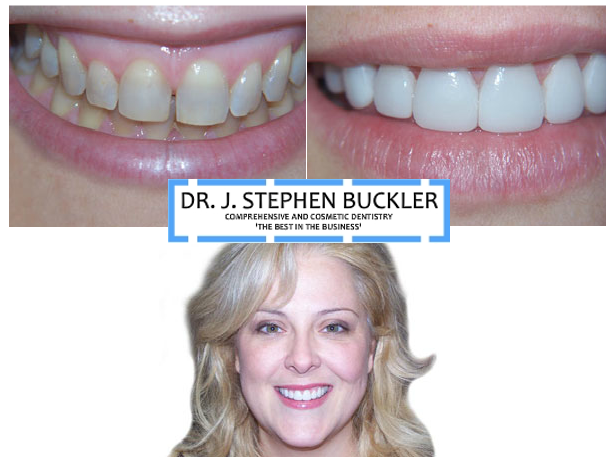 Express smile atlanta coupon code