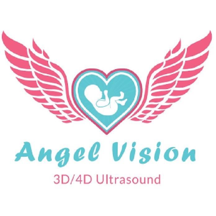Angelvision 3D4d Ultrasound