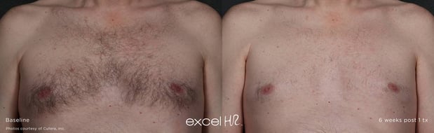 Images Celtic Spa & Laser Services