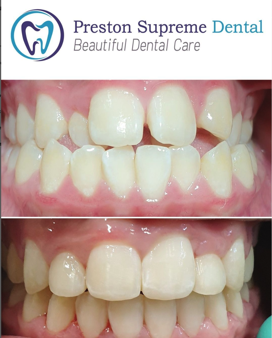 Images Preston Supreme Dental