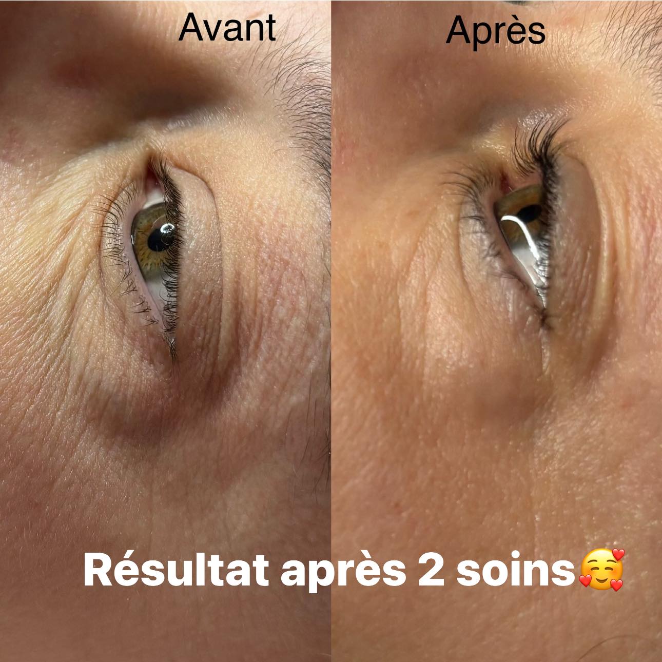 Images MKN Esthétique Laser & Bien-être