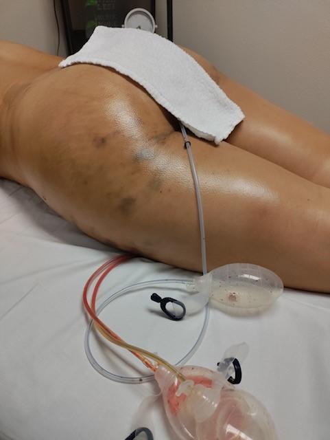 Images LM THERAPEUTICS
