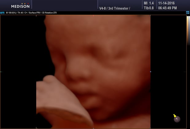 Images Heavenly 3D 4D Ultrasounds