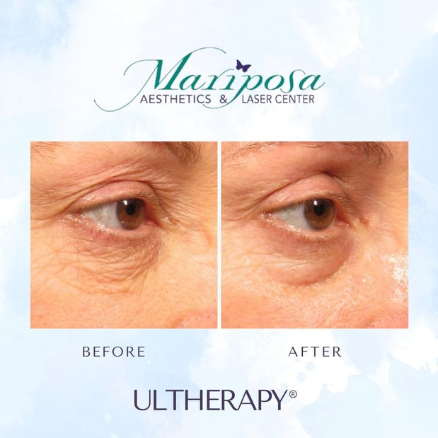 Images Mariposa Aesthetics & Laser Center