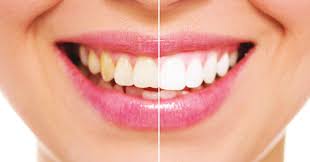 Images Studio Odontoiatrico P&L Pldental