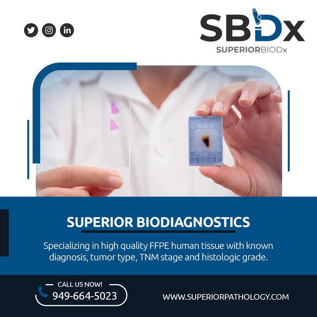 Images Superior BioDiagnostics