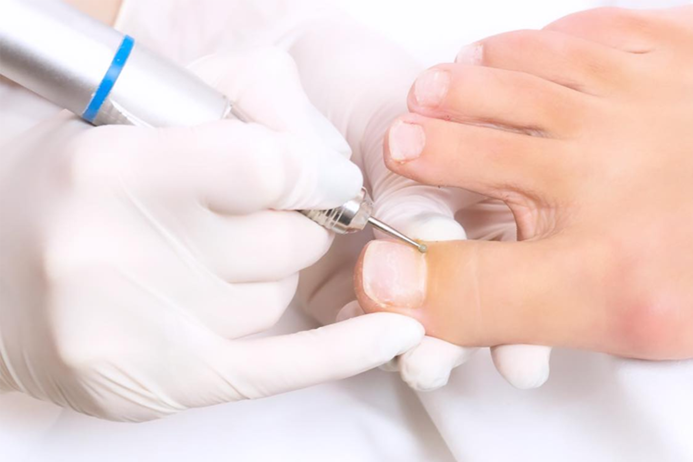 Images Fotterapeut Helle Sulland