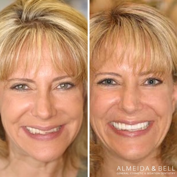 Images Almeida & Bell Dental Lone Tree - General, Cosmetic, and Implant Dentistry