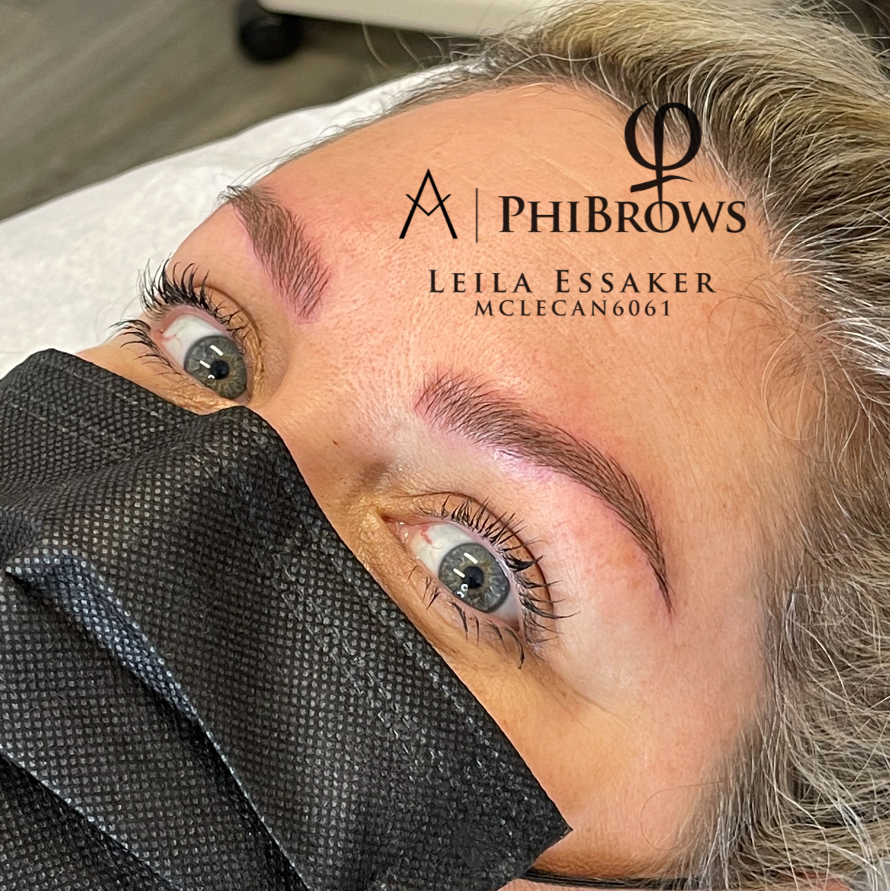 Images Clinique d'Esthétique Leila - Hydrafacial, Microblading, Épilation Laser Sainte-Foy