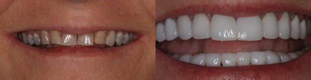 Images Arnaud M. De Buyl, DDS, FAGD