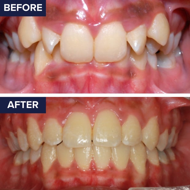 Images Orthodontics of Santa Barbara