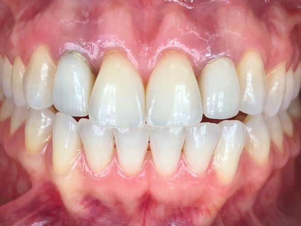 Images Nicole E. Kuske, DDS
