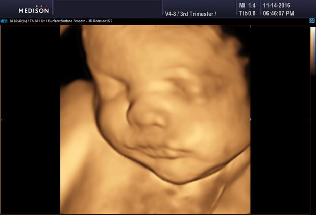 Images Heavenly 3D 4D Ultrasounds