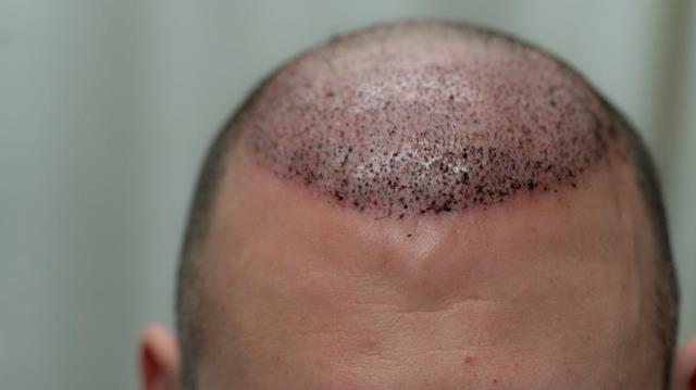 Images Bijan Clinic