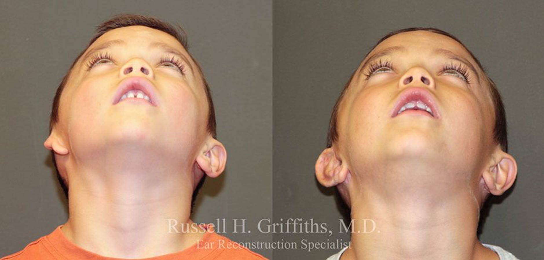 Results of Russell H. Griffiths, MD | Boise, ID