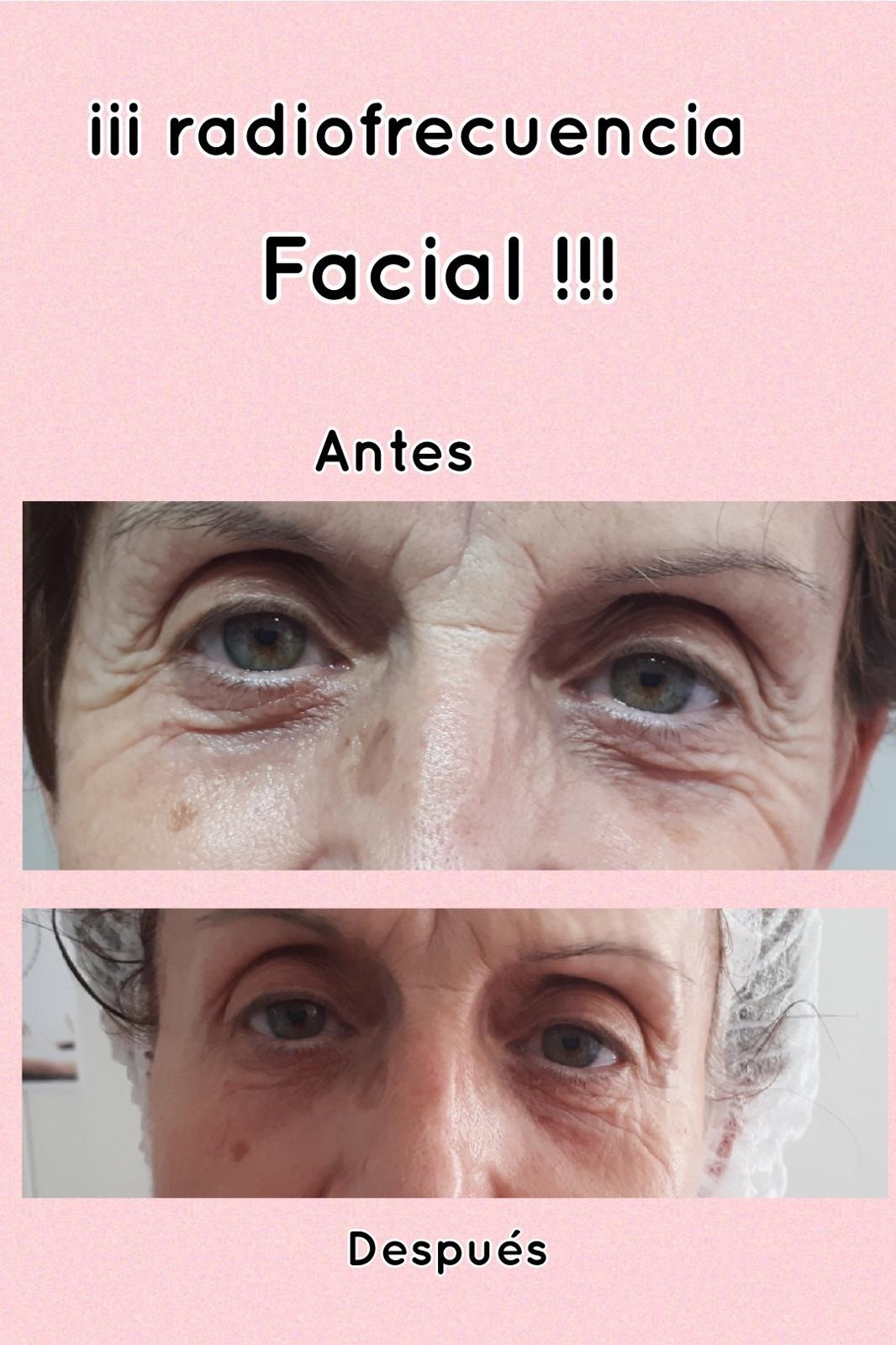 Images Centro De Estética Avanzada Y Láser Verónica Vico
