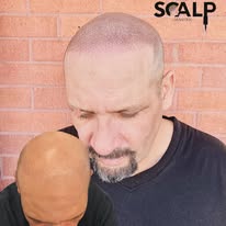 Images The Scalp Master