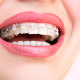 Images Bear Creek Dentistry & Orthodontics