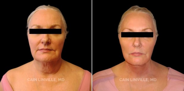 Images Linville Plastic Surgery