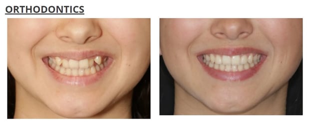Images Aspen Ridge Dental