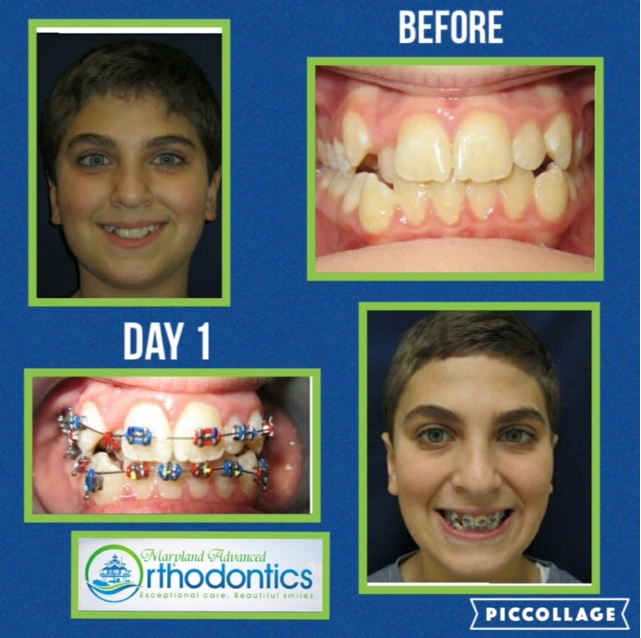 Images Maryland Advanced Orthodontics: David S. Lavine, DDS, MS