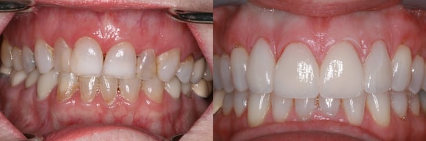 Images Campbell Dental Arts