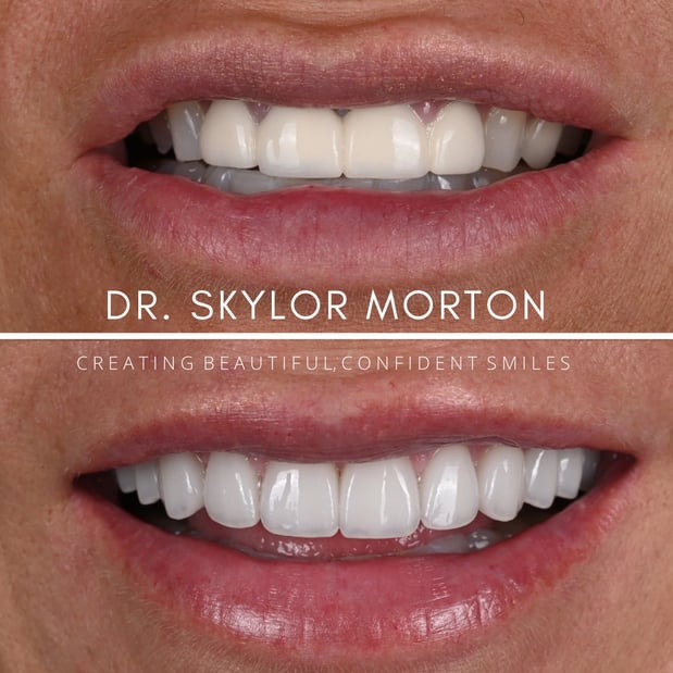 Images Nashville Wisdom Teeth and Implant Solutions