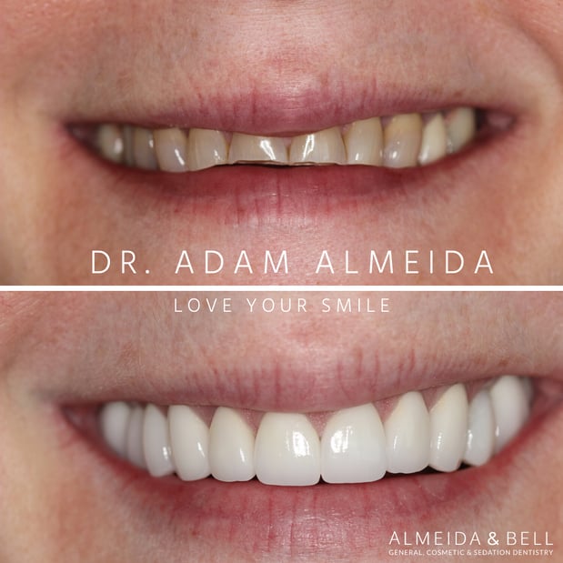 Images Almeida & Bell Dental Lone Tree - General, Cosmetic, and Implant Dentistry