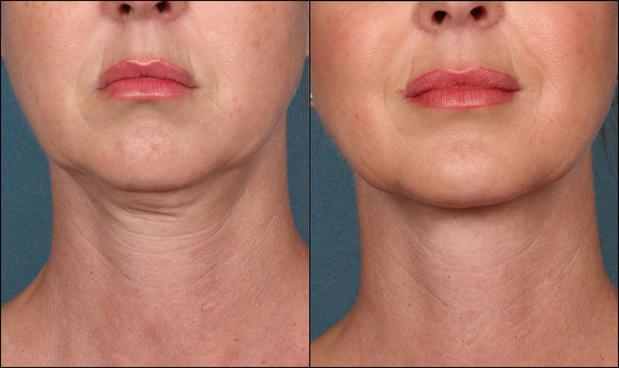 Images High Valley Dermatology