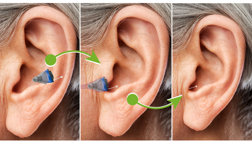 SCHOLAND HÖRAKUSTIK, Lange Strasse 14 in Lohfelden