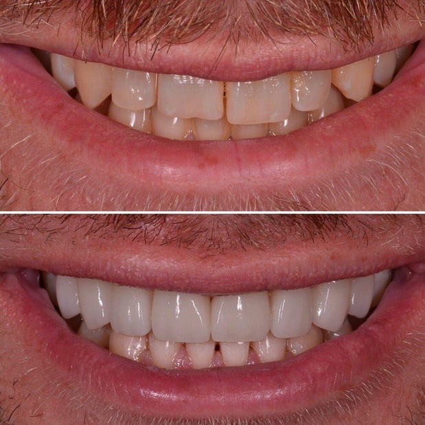 Images Carson Dental & Cosmetic Centre