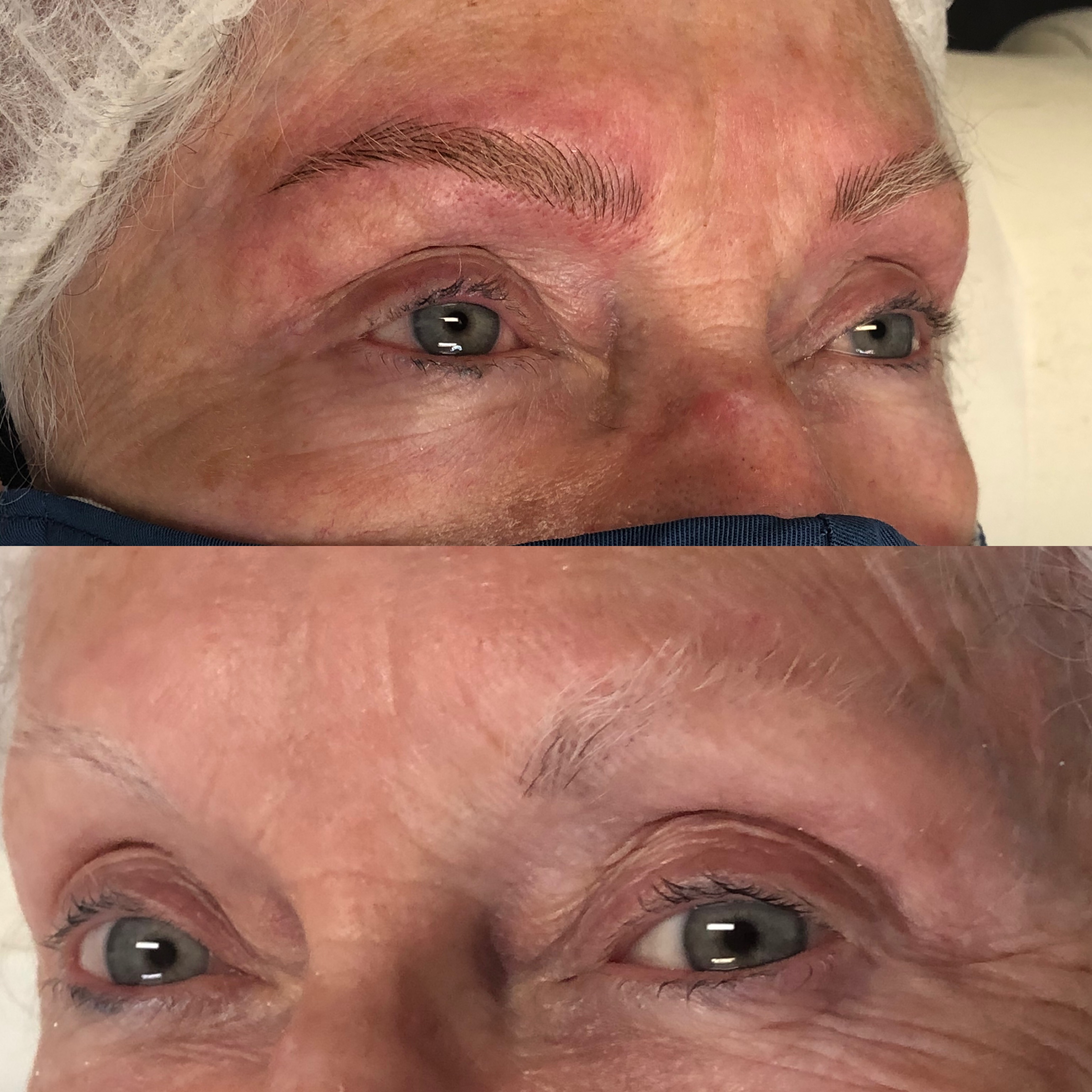 Images Clinique d'Esthétique Leila - Hydrafacial, Microblading, Épilation Laser Sainte-Foy