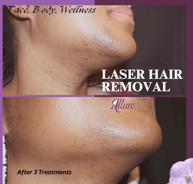 Images Allure Laser & Med Spa