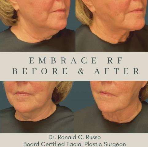 Images Rejuvenis Facial Cosmetic Surgery and Medical Spa