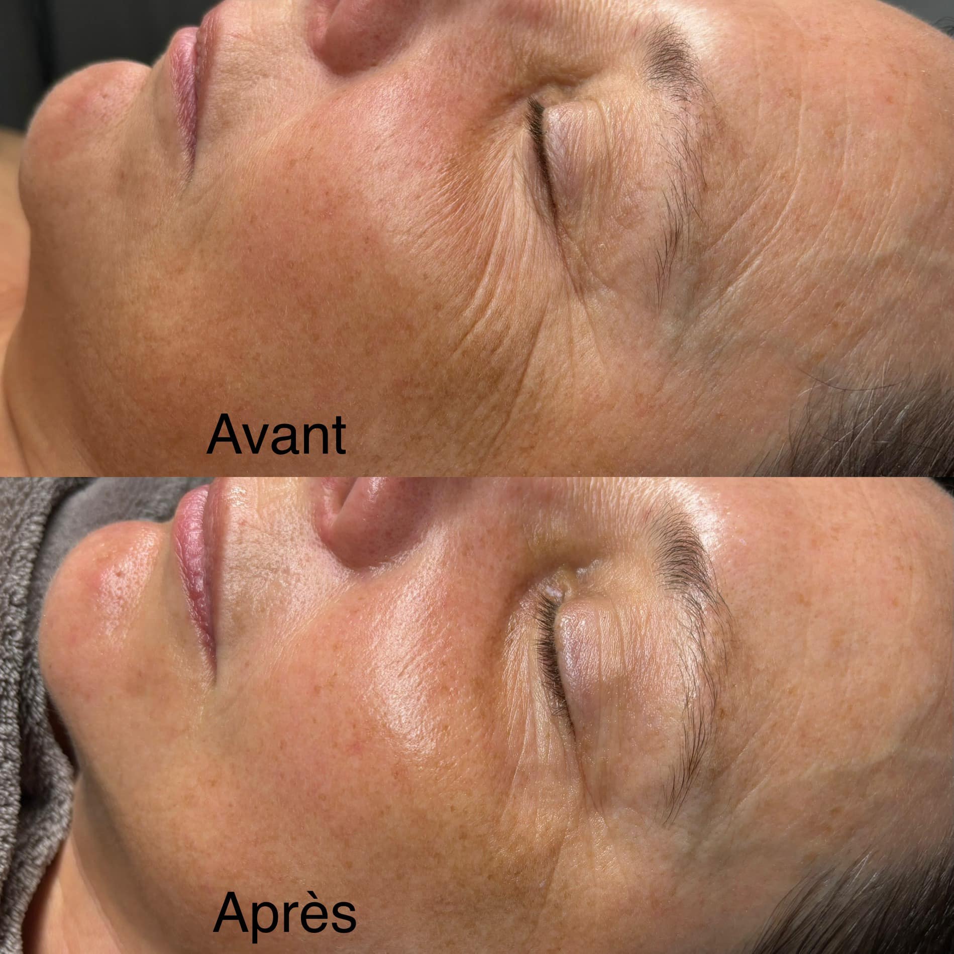 Images MKN Esthétique Laser & Bien-être