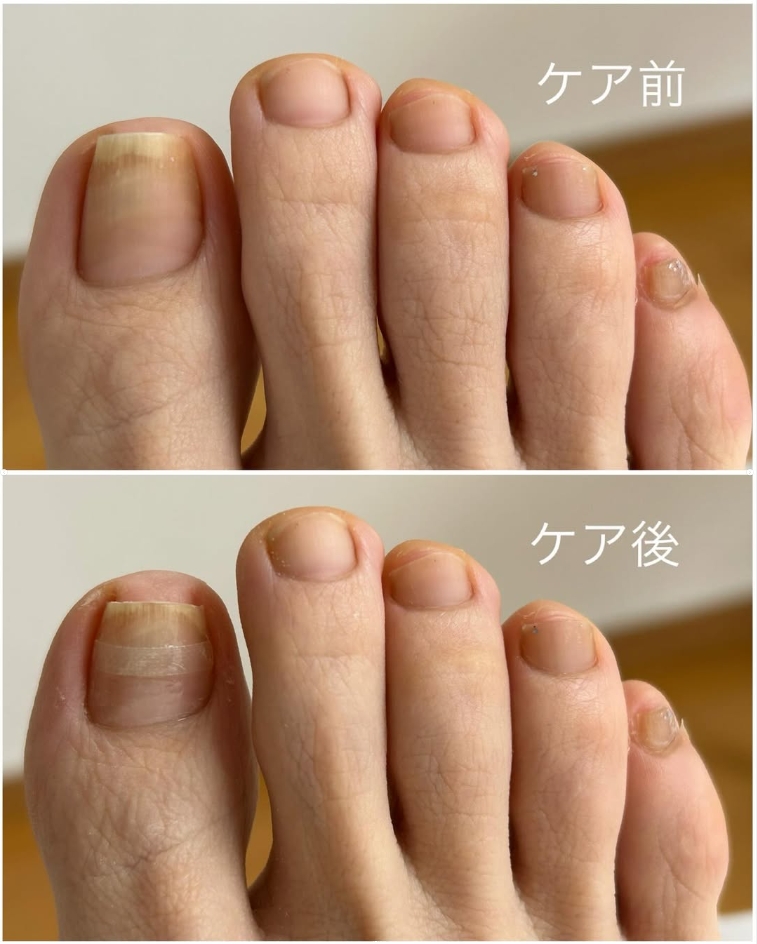 Images 足の専門店 おん