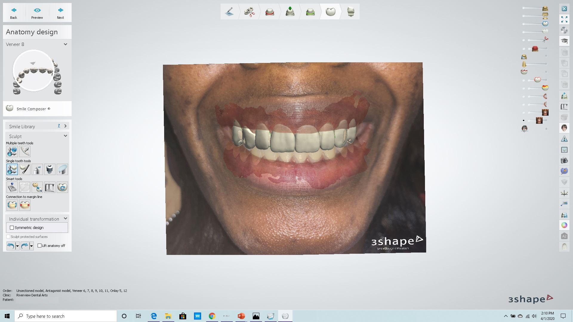 Gallery thumbnail
